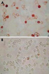 Anti-ORF62 Mouse Monoclonal Antibody [clone: 5B7B6]