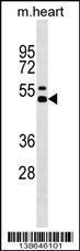 Anti-IL12B Rabbit Polyclonal Antibody (HRP (Horseradish Peroxidase))