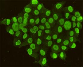 Anti-CDX2 Mouse Monoclonal Antibody [clone: 13k30]