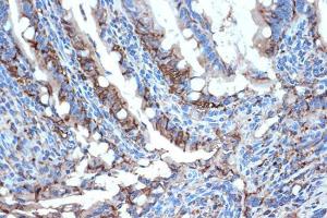 Immunohistochemistry analysis of paraffin-embedded rat intestine using Anti-I-FABP Antibody [ARC1343] (A306889) at a dilution of 1:100 (40X lens). Perform microwave antigen retrieval with 10 mM Tris/EDTA buffer pH 9.0 before commencing with IHC staining protocol