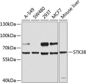 Anti-STK38 Rabbit Polyclonal Antibody