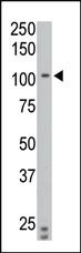 Anti-PTPIA2 beta Rabbit Polyclonal Antibody