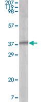 Anti-ORF62 Mouse Monoclonal Antibody [clone: 5B7B6]