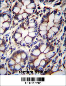 Anti-IQCA1 Rabbit Polyclonal Antibody (HRP (Horseradish Peroxidase))