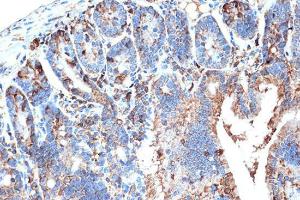 Immunohistochemistry analysis of paraffin-embedded mouse intestin using Anti-I-FABP Antibody [ARC1343] (A306889) at a dilution of 1:100 (40X lens). Perform microwave antigen retrieval with 10 mM Tris/EDTA buffer pH 9.0 before commencing with IHC staining protocol