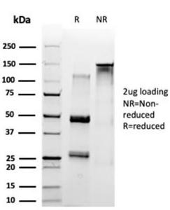 SDS-PAGE analysis of Anti-SET Antibody [PCRP-SET-1C6] under non-reduced and reduced conditions; showing intact IgG and intact heavy and light chains, respectively. SDS-PAGE analysis confirms the integrity and purity of the Antibody