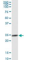 Anti-NMRK1 Polyclonal Antibody Pair