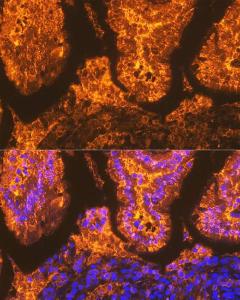 Immunofluorescence analysis of mouse intestin using Anti-I-FABP Antibody [ARC1343] (A306889) at a dilution of 1:100 (40X lens). DAPI was used to stain the cell nuclei (blue)