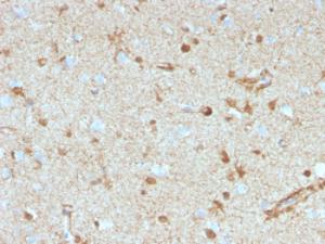 Immunohistochemical analysis of formalin-fixed, paraffin-embedded human brain tissue using Anti-S100 beta Antibody [S100B/4153] at 2 µg/ml