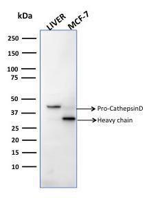 Western blot analysis of human liver tissue and MCF-7 cell lysates using Anti-Cathepsin D Antibody [CTSD/2781]