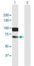 Anti-HIRIP3 Mouse Polyclonal Antibody