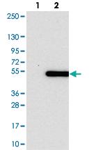 Anti-PSMD11 Rabbit Polyclonal Antibody