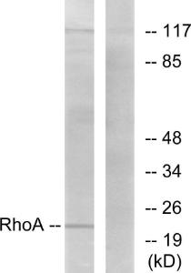 Western blot analysis of lysates from HepG2 cells using Anti-RhoA Antibody. The right hand lane represents a negative control, where the antibody is blocked by the immunising peptide.