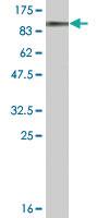 Anti-DDX20 Mouse Monoclonal Antibody [clone: 2A12]