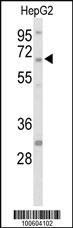 Anti-PTPN5 Rabbit Polyclonal Antibody [clone: 423CT7.9.2]