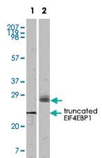 Anti-EIF4EBP1 Mouse Monoclonal Antibody [clone: 9E12D9]