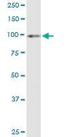 Anti-TPO Polyclonal Antibody Pair