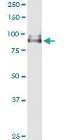 Anti-POLH Polyclonal Antibody Pair