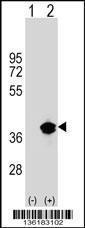 Anti-PPT1 Rabbit Polyclonal Antibody (AP (Alkaline Phosphatase))