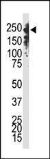 Anti-DNMT1 Rabbit Polyclonal Antibody