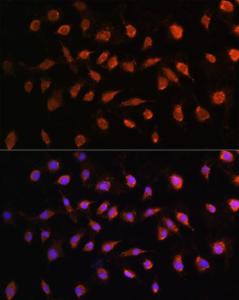 Anti-STK38 Rabbit Polyclonal Antibody