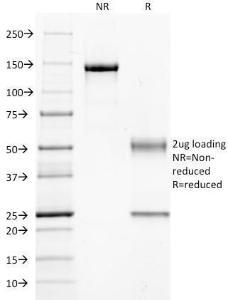 SDS-PAGE analysis of Anti-CD14 Antibody [LPSR/654] under non-reduced and reduced conditions; showing intact IgG and intact heavy and light chains, respectively. SDS-PAGE analysis confirms the integrity and purity of the antibody