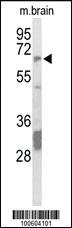 Anti-PTPN5 Rabbit Polyclonal Antibody [clone: 423CT7.9.2]