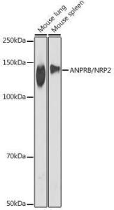 Western blot analysis of extracts of various cell lines, using Anti-NPR-B Antibody [ARC2421] (A308065) at 1:1,000 dilution. The secondary antibody was Goat Anti-Rabbit IgG H&L Antibody (HRP) at 1:10,000 dilution.