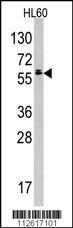 Anti-TESK2 Rabbit Polyclonal Antibody (HRP (Horseradish Peroxidase))