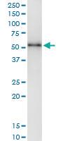 Anti-TYMP Polyclonal Antibody Pair