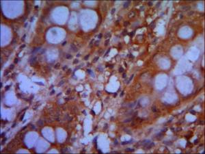 Anti-CHD3 Mouse Monoclonal Antibody [clone: 13k31]