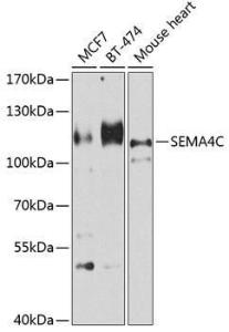 Anti-SEMA4C/SEMAI Rabbit Polyclonal Antibody