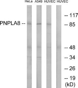 Western blot analysis of lysates from HUVEC, HeLa, and A549 cells using Anti-PNPLA8 Antibody. The right hand lane represents a negative control, where the Antibody is blocked by the immunising peptide