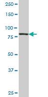 Anti-PIK3R1 Mouse Monoclonal Antibody [clone: 3C11]