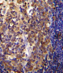 Anti-His6-DEP-1 Rabbit Polyclonal Antibody