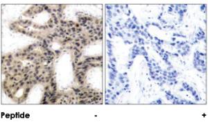 Anti-EIF4EBP1 Rabbit Polyclonal Antibody