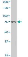 Anti-PIK3R1 Mouse Monoclonal Antibody [clone: 3C11]