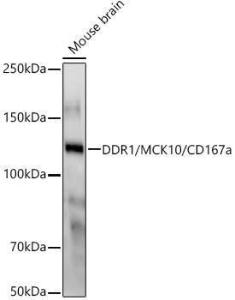 Anti-MCK10/NEP antibody