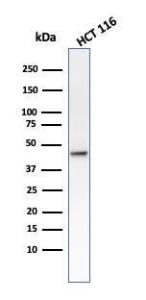 Western blot analysis of HCT116 cell lysate using Anti-Cytokeratin 8 Antibody [B22.1]