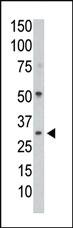 Anti-PPP1CC Rabbit Polyclonal Antibody