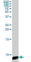 Anti-ATOX1 Mouse Monoclonal Antibody [clone: 4D6]