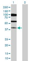 Anti-PDX1 Rabbit Polyclonal Antibody