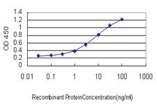 Anti-CILP Mouse Monoclonal Antibody [clone: 2C5]