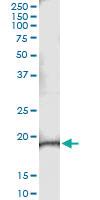 Anti-NMRK1 Antibody Pair