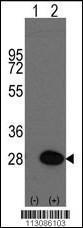 Anti-HSPB1 Rabbit Polyclonal Antibody (FITC (Fluorescein))