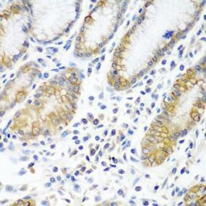 Immunohistochemistry analysis of paraffin-embedded human stomach using Anti-ATAD3A Antibody (A12226) at a dilution of 1:100 (40x lens). Perform microwave antigen retrieval with 10 mM PBS buffer pH 7.2 before commencing with IHC staining protocol