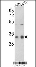 Anti-PPP1CC Rabbit Polyclonal Antibody