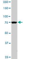 Anti-PIK3R1 Mouse Monoclonal Antibody [clone: 3C11]