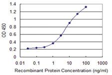 Anti-CILP Mouse Monoclonal Antibody [clone: 2D10]