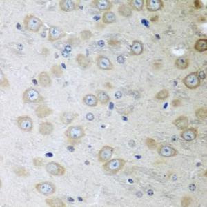 Immunohistochemistry analysis of paraffin-embedded mouse brain using Anti-ATAD3A Antibody (A12226) at a dilution of 1:100 (40x lens). Perform microwave antigen retrieval with 10 mM PBS buffer pH 7.2 before commencing with IHC staining protocol